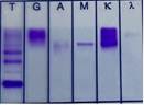 A close-up of a test
Description automatically generated