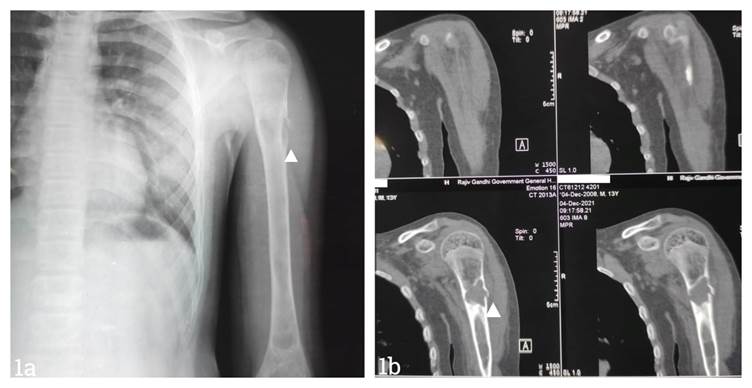 A close-up of x-ray images
Description automatically generated